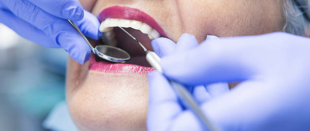 Best Broken or Chipped Tooth Repair in Mount Angel, OR